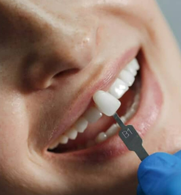 Dental Care